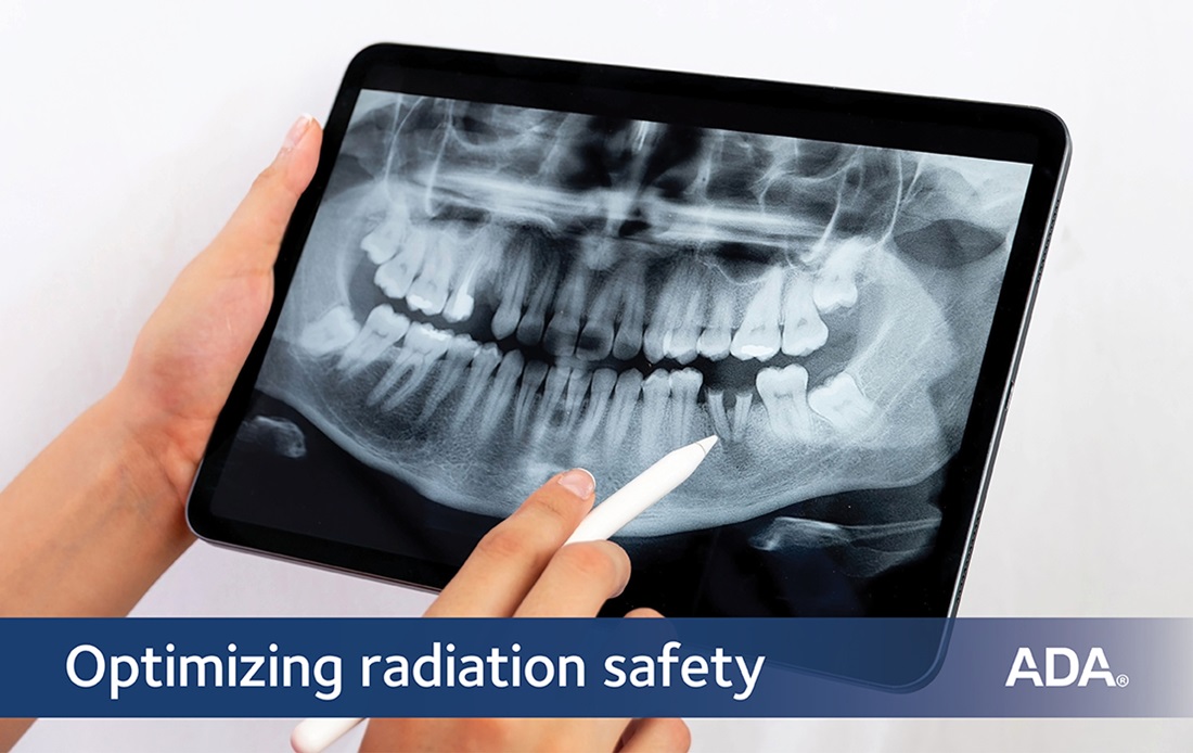 Optimizing radiation safety.