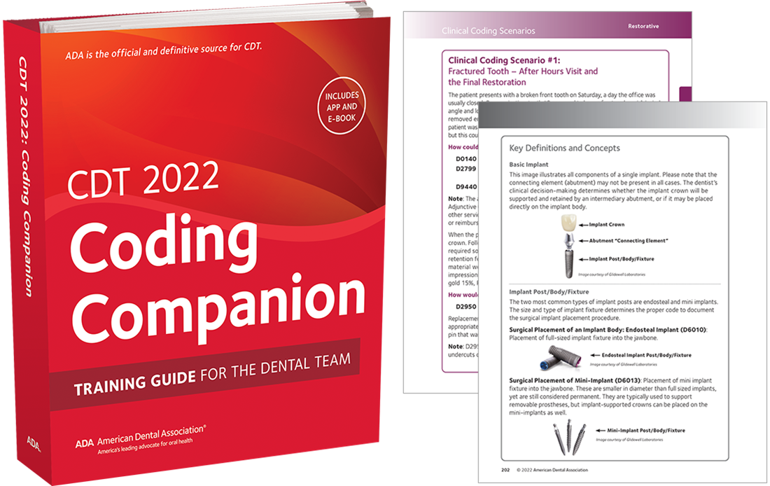 ADA CDT Coding Companion and sample pages