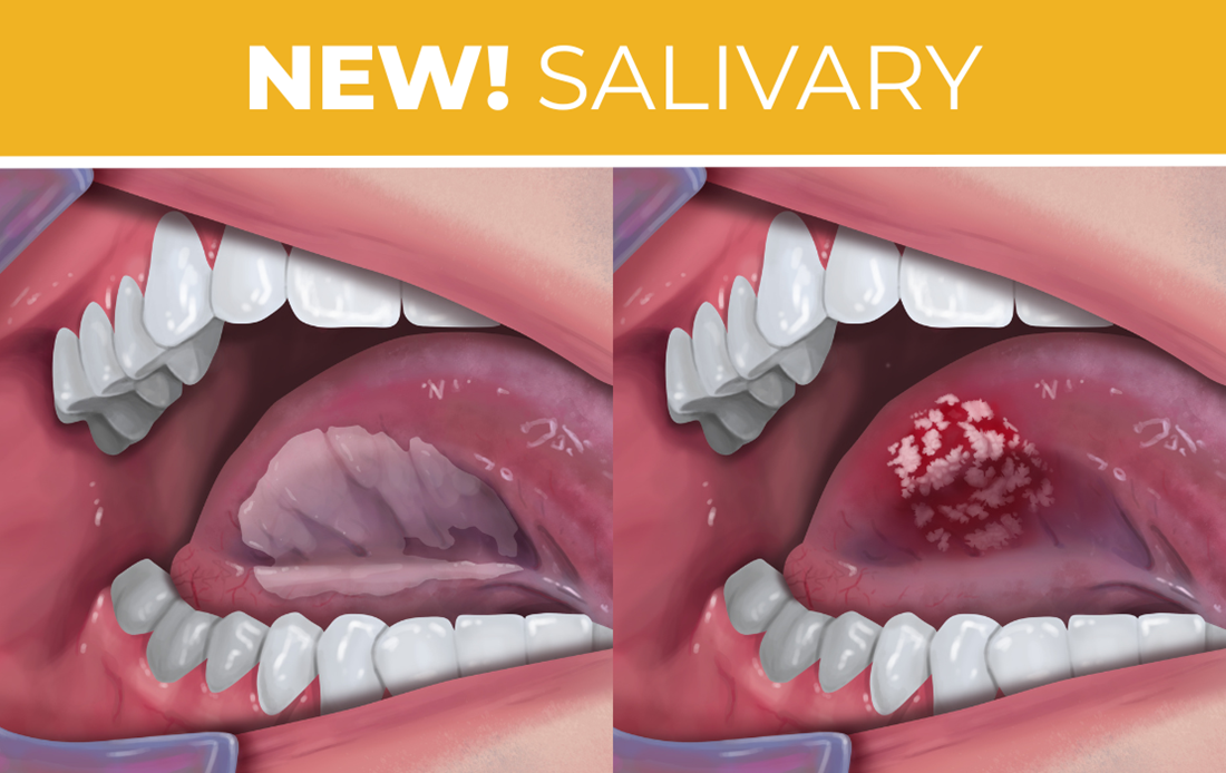 New! Salivary images of mouths