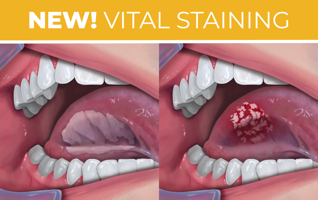 Vital staining