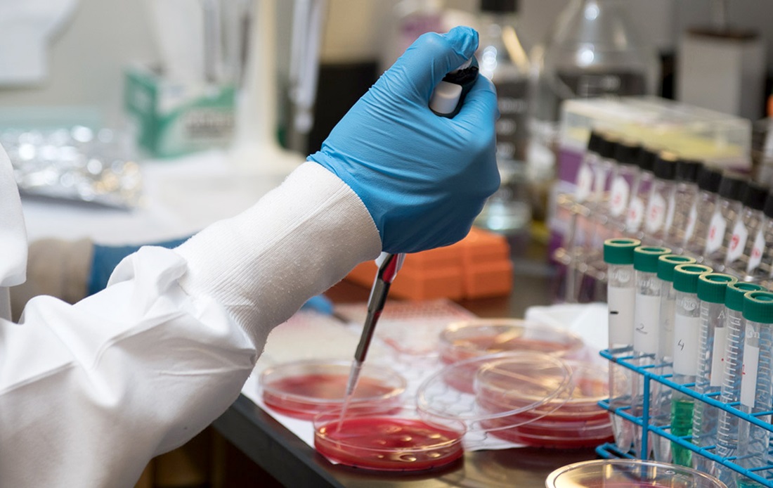 A close-up photograph of a lab technician taking a sample from a Petri dish.