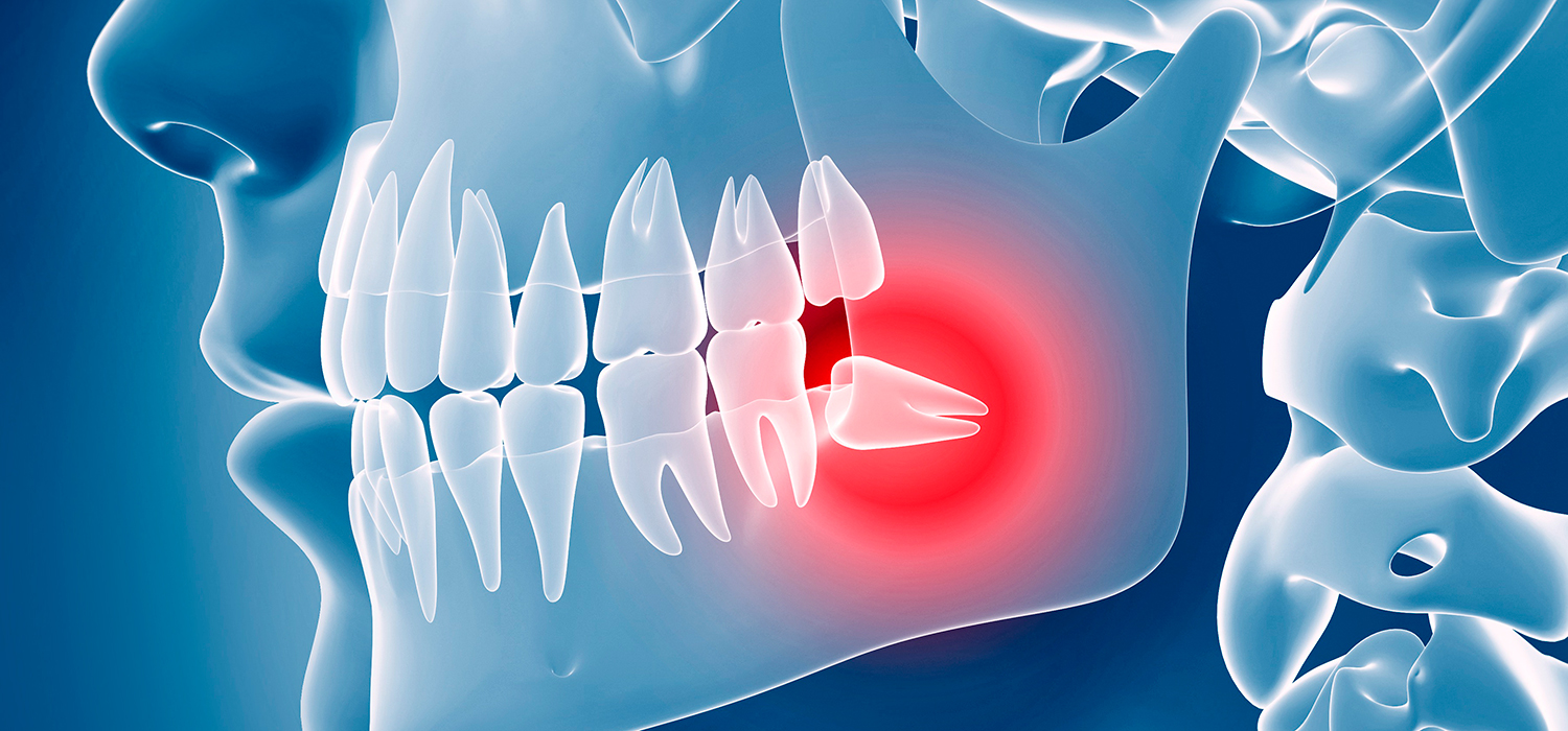 Clinical evidence for the use of dental painkillers.