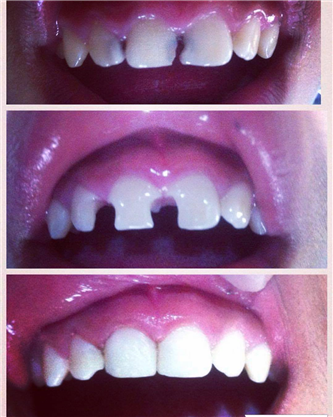 Before After Treatment Photos