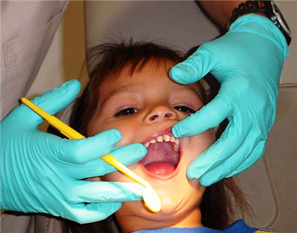 Child's mouth being held open by dentist