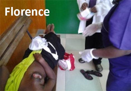 Photo of woman who has an injury to her breast, lying on a bench 