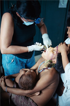 Photo of a dental volunteer performing dental treatments on an adult holding a small child